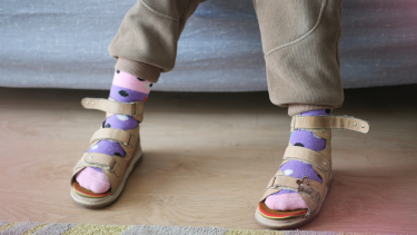 Paralisia Cerebral Infantil: Atividades que Melhoram a Mobilidade